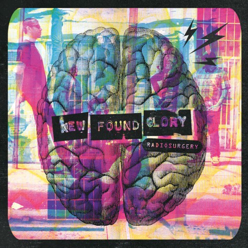 Radiosurgery封面