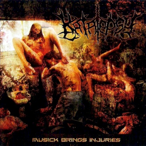Musick Brings Injuries封面