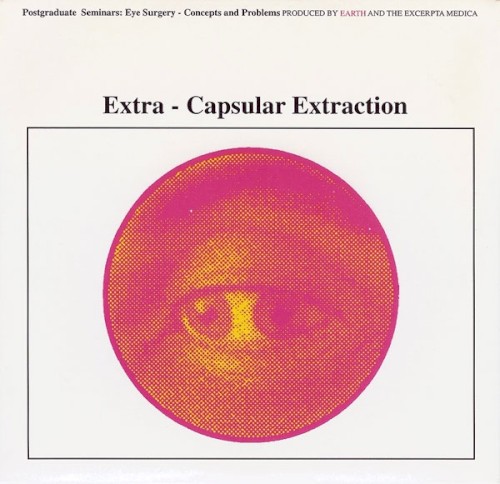 Extra‐Capsular Extraction封面
