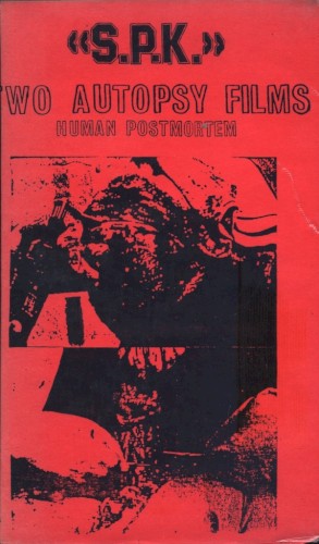 Two Autopsy Films: Human Postmortem封面