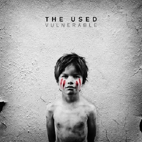 Vulnerable封面