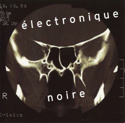 Électronique noire封面